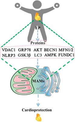 Compositions and Functions of Mitochondria-Associated Endoplasmic Reticulum Membranes and Their Contribution to Cardioprotection by Exercise Preconditioning